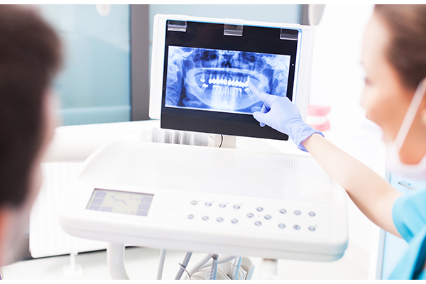 3-D CBCT Dental Scans & Digital X-rays